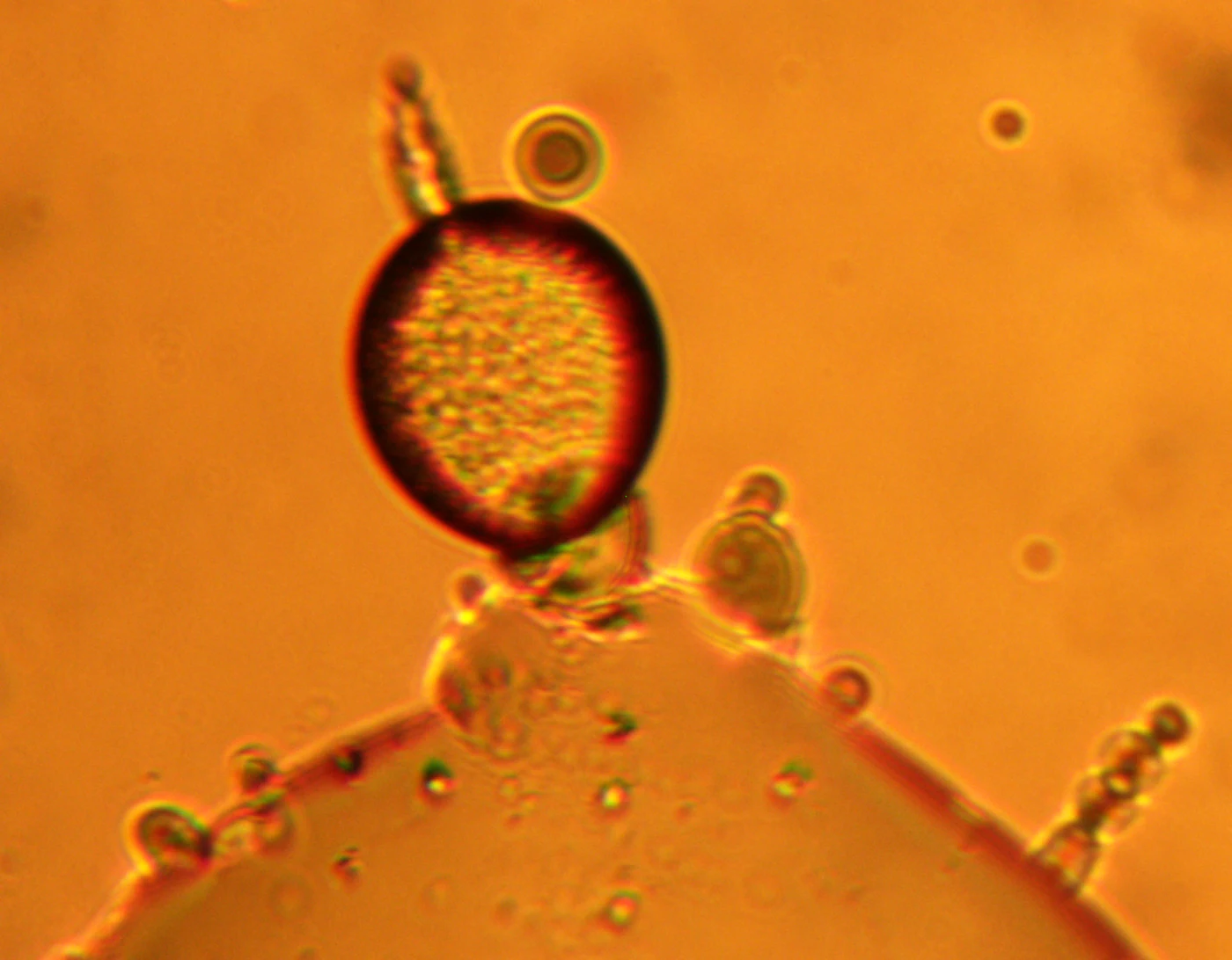 A particle-filled vesicle joined to its neighbors in a chain.