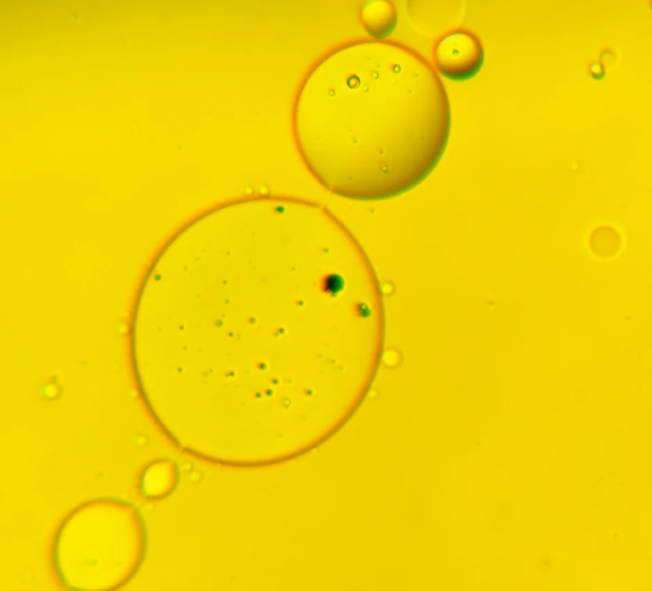 A chain of vesicles of different sizes.